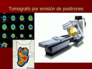 Tomografo  por emisión de positrones 