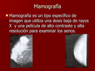 Mamografía Mamografía es un tipo específico de imagen que utiliza una dosis baja de rayos X  y una película de alto contraste y alta resolución para examinar los senos. 