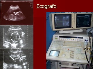 Ecografo 