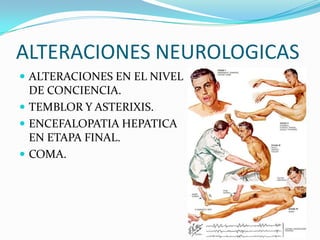 ALTERACIONES NEUROLOGICAS
 ALTERACIONES EN EL NIVEL
DE CONCIENCIA.
 TEMBLOR Y ASTERIXIS.
 ENCEFALOPATIA HEPATICA
EN ETAPA FINAL.
 COMA.
 