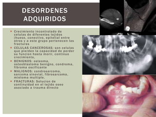 DESORDENES 
ADQUIRIDOS 
 Crecimiento incont rolado de 
celulas de di ferentes tej idos 
(hueso, conect ivo, epi tel ial ent re 
ot ros y a este grupo per tenecen las 
f racturas 
 CELULAS CANCEROSAS: son celulas 
que pierden la capacidad de perder 
su funcion hasta mor i r, cont inuo 
crecimiento, 
 BENIGNOS: osteoma, 
osteoblastoma benigno, condroma, 
f ibroma osci f icante 
 MALIGNOS: condrosarcoma, 
sarcoma sinovial , f ibrosarcoma, 
mieloma mul t iple. 
 FRACTURAS: Solucion de 
cont inuidad en el tej ido oseo 
asociado a t rauma di recto 
 