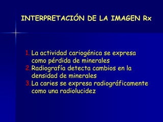 INTERPRETACIÓN DE LA IMAGEN Rx




1. La actividad cariogénica se expresa
   como pérdida de minerales
2. Radiografía detecta cambios en la
   densidad de minerales
3. La caries se expresa radiográficamente
   como una radiolucidez
 