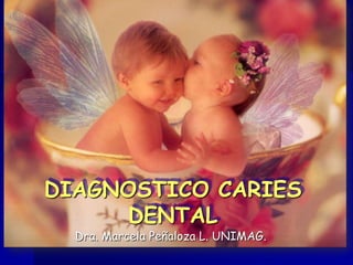 DIAGNOSTICO CARIES
      DENTAL
  Dra. Marcela Peñaloza L. UNIMAG.
 