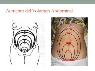 Aumento del Volumen Abdominal
 