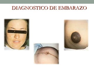DIAGNOSTICO DE EMBARAZO
 