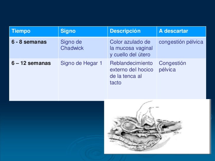 Diagnostico de embarazo sandy