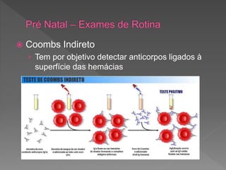  Coombs Indireto
› Tem por objetivo detectar anticorpos ligados à
superfície das hemácias
 