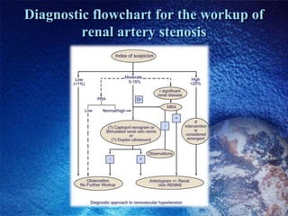 Diagnostic flowchart for the workup of
         renal artery stenosis
 