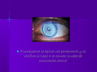  Fluoresceína se aplica vía paraenteral y seFluoresceína se aplica vía paraenteral y se
verifica si llegó a la cornea, prueba deverifica si llegó a la cornea, prueba de
circulación activacirculación activa
 