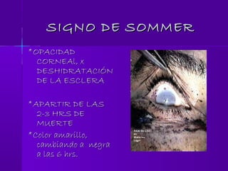 SIGNO DE SOMMERSIGNO DE SOMMER
*OPACIDAD*OPACIDAD
CORNEAl, xCORNEAl, x
DESHIDRATACIÓNDESHIDRATACIÓN
DE LA ESCLERADE LA ESCLERA
*APARTIR DE LAS*APARTIR DE LAS
2-3 HRS DE2-3 HRS DE
MUERTEMUERTE
*Color amarillo,*Color amarillo,
cambiando a negracambiando a negra
a las 6 hrs.a las 6 hrs.
 