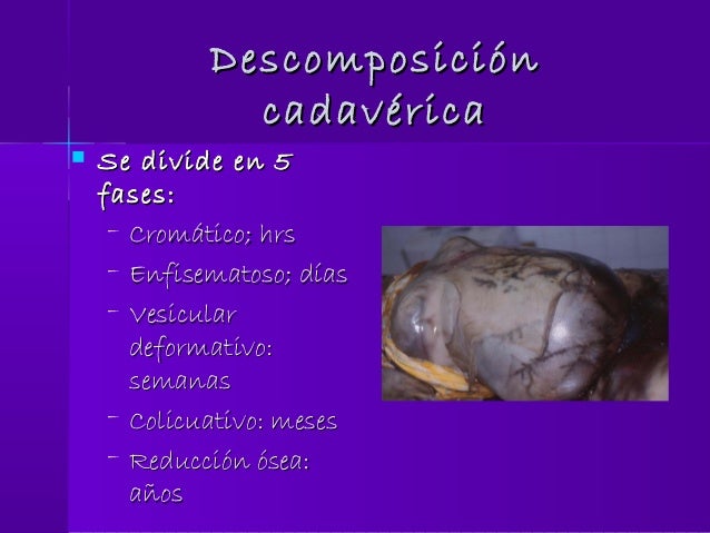 Diagnostico de muerte