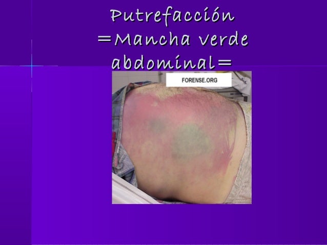 Diagnostico de muerte