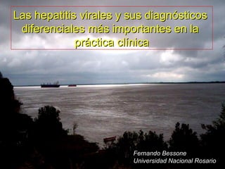 Las hepatitis virales y sus diagnósticos  diferenciales más importantes en la  práctica clínica Fernando Bessone Universidad Nacional Rosario 