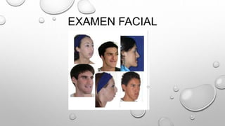 EXAMEN FACIAL
 