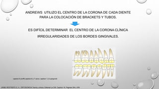 ANDREWS UTILIZO EL CENTRO DE LA CORONA DE CADA DIENTE
PARA LA COLOCACIÓN DE BRACKETS Y TUBOS.
ES DIFÍCIL DETERMINAR EL CENTRO DE LA CORONA CLÍNICA
IRREGULARIDADES DE LOS BORDES GINGIVALES.
URIBE RESTREPO G. A., ORTODONCIA Teoría y clínica, Editorial La CIB, Capitulo 16, Paginas 304 y 305.
capitulo 6 proffit,capitulo 6 y 7 canut, capitulo 1,2,3 gregroret
 