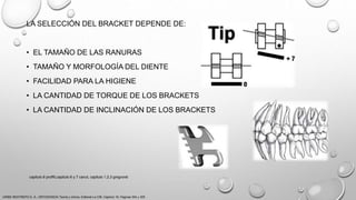 LA SELECCIÓN DEL BRACKET DEPENDE DE:
• EL TAMAÑO DE LAS RANURAS
• TAMAÑO Y MORFOLOGÍA DEL DIENTE
• FACILIDAD PARA LA HIGIENE
• LA CANTIDAD DE TORQUE DE LOS BRACKETS
• LA CANTIDAD DE INCLINACIÓN DE LOS BRACKETS
URIBE RESTREPO G. A., ORTODONCIA Teoría y clínica, Editorial La CIB, Capitulo 16, Paginas 304 y 305.
capitulo 6 proffit,capitulo 6 y 7 canut, capitulo 1,2,3 gregroret
 