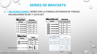 SERIES DE BRACKETS
• SIN EXTRACCIONES. VIENEN CON LA FORMULA ESTÁNDAR DE TORQUE,
INCLINACIONES IN-SET Y OUTS-SET
URIBE RESTREPO G. A., ORTODONCIA Teoría y clínica, Editorial La CIB, Capitulo 16, Paginas 304 y 305.
capitulo 6 proffit,capitulo 6 y 7 canut, capitulo 1,2,3 gregroret
 