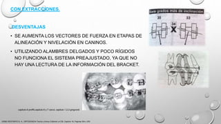 CON EXTRACCIONES.
DESVENTAJAS
• SE AUMENTA LOS VECTORES DE FUERZA EN ETAPAS DE
ALINEACIÓN Y NIVELACIÓN EN CANINOS.
• UTILIZANDO ALAMBRES DELGADOS Y POCO RÍGIDOS
NO FUNCIONA EL SISTEMA PREAJUSTADO, YA QUE NO
HAY UNA LECTURA DE LA INFORMACIÓN DEL BRACKET.
URIBE RESTREPO G. A., ORTODONCIA Teoría y clínica, Editorial La CIB, Capitulo 16, Paginas 304 y 305.
capitulo 6 proffit,capitulo 6 y 7 canut, capitulo 1,2,3 gregroret
 