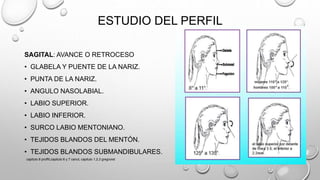 ESTUDIO DEL PERFIL
SAGITAL: AVANCE O RETROCESO
• GLABELA Y PUENTE DE LA NARIZ.
• PUNTA DE LA NARIZ.
• ANGULO NASOLABIAL.
• LABIO SUPERIOR.
• LABIO INFERIOR.
• SURCO LABIO MENTONIANO.
• TEJIDOS BLANDOS DEL MENTÓN.
• TEJIDOS BLANDOS SUBMANDIBULARES.
capitulo 6 proffit,capitulo 6 y 7 canut, capitulo 1,2,3 gregroret
 