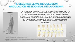 II. SEGUNDA LLAVE DE OCLUSIÓN
ANGULACIÓN MESIODISTAL DE LA CORONA.
LA PORCIÓN GINGIVAL DEL EJE LONGITUDINAL DE LA
CORONA DEBERÁ ESTAR UBICADA LIGERAMENTE
DISTAL A LA PORCIÓN OCLUSAL DEL EJE LONGITUDINAL
DE LA CORONA PARA QUE EXISTA UNA OCLUSIÓN
NORMAL
GREGORET J., TUBER E., ESCOBAR H., EL TRATAMIENTO ORTODONTICO CON ARCO RECTO, NM Ediciones, Año 2003,
Paginas 16 a 23.
capitulo 6 proffit,capitulo 6 y 7 canut, capitulo 1,2,3 gregroret
 