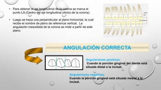 Angulaciones positivas:
Cuando la porción gingival del diente está
situada distal a la incisal.
ANGULACIÓN CORRECTA
Angulaciones negativas:
Cuando la porción gingival está situada mesial a la
incisal.
• Para obtener el eje longitudinal de la corona se marca el
punto LA (Centro del eje longitudinal clínico de la corona).
• Luego se traza una perpendicular al plano horizontal, la cual
recibe el nombre de plano de referencia vertical. La
angulación mesodistal de la corona se mide a partir de este
plano.
 