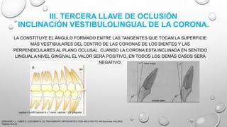 III. TERCERA LLAVE DE OCLUSIÓN
INCLINACIÓN VESTIBULOLINGUAL DE LA CORONA.
LA CONSTITUYE EL ÁNGULO FORMADO ENTRE LAS TANGENTES QUE TOCAN LA SUPERFICIE
MÁS VESTIBULARES DEL CENTRO DE LAS CORONAS DE LOS DIENTES Y LAS
PERPENDICULARES AL PLANO OCLUSAL. CUANDO LA CORONA ESTA INCLINADA EN SENTIDO
LINGUAL A NIVEL GINGIVAL EL VALOR SERÁ POSITIVO, EN TODOS LOS DEMÁS CASOS SERÁ
NEGATIVO.
GREGORET J., TUBER E., ESCOBAR H., EL TRATAMIENTO ORTODONTICO CON ARCO RECTO, NM Ediciones, Año 2003,
Paginas 16 a 23.
capitulo 6 proffit,capitulo 6 y 7 canut, capitulo 1,2,3 gregroret
 