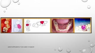 capitulo 6 proffit,capitulo 6 y 7 canut, capitulo 1,2,3 gregroret
 