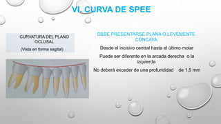 VI. CURVA DE SPEE
DEBE PRESENTARSE PLANA O LEVEMENTE
CÓNCAVA
Desde el incisivo central hasta el último molar
Puede ser diferente en la arcada derecha o la
izquierda
No deberá exceder de una profundidad de 1,5 mm
CURVATURA DEL PLANO
OCLUSAL
(Vista en forma sagital)
 