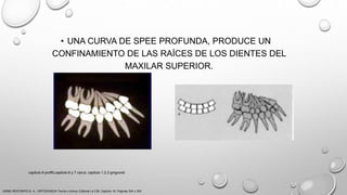 • UNA CURVA DE SPEE PROFUNDA, PRODUCE UN
CONFINAMIENTO DE LAS RAÍCES DE LOS DIENTES DEL
MAXILAR SUPERIOR.
URIBE RESTREPO G. A., ORTODONCIA Teoría y clínica, Editorial La CIB, Capitulo 16, Paginas 304 y 305.
capitulo 6 proffit,capitulo 6 y 7 canut, capitulo 1,2,3 gregroret
 