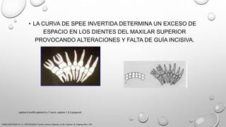 • LA CURVA DE SPEE INVERTIDA DETERMINA UN EXCESO DE
ESPACIO EN LOS DIENTES DEL MAXILAR SUPERIOR
PROVOCANDO ALTERACIONES Y FALTA DE GUÍA INCISIVA.
URIBE RESTREPO G. A., ORTODONCIA Teoría y clínica, Editorial La CIB, Capitulo 16, Paginas 304 y 305.
capitulo 6 proffit,capitulo 6 y 7 canut, capitulo 1,2,3 gregroret
 