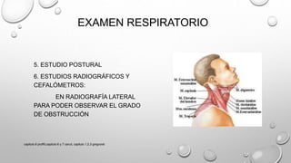 EXAMEN RESPIRATORIO
5. ESTUDIO POSTURAL
6. ESTUDIOS RADIOGRÁFICOS Y
CEFALÓMETROS:
EN RADIOGRAFÍA LATERAL
PARA PODER OBSERVAR EL GRADO
DE OBSTRUCCIÓN
capitulo 6 proffit,capitulo 6 y 7 canut, capitulo 1,2,3 gregroret
 
