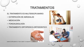 TRATAMIENTOS
EL TRATAMIENTO ES MULTIDISCIPLINARIO:
• EXTIRPACIÓN DE AMÍGDALAS
• MEDICACIÓN
• FONOAUDIOLOGÍA
• TRATAMIENTO ORTOPEDICO-ORTODONTICO
capitulo 6 proffit,capitulo 6 y 7 canut, capitulo 1,2,3 gregroret
 