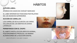HÁBITOS
SUCCIÓN LABIAL:
APARECE EN CASOS DE OVERJET MARCADO
EL LABIO INFERIOR SE POSICIONA POR PALATINO
DE LOS INCISIVOS SUPERIORES
SUCCIÓN DE CARRILLOS:
LOS CARRILLOS SE ALOJAN EN LAS CARAS
OCLUSALES DE LOS DIENTES EN ZONAS
LATERALES
PERSISTENCIA CON EL CHUPO:
EL HABITO HASTA LOS DOS AÑOS ES NORMAL,
POSTERIORMENTE PRODUCE LAS MISMAS
ALTERACIONES DE LA SUCCIÓN DIGITAL
capitulo 6 proffit,capitulo 6 y 7 canut, capitulo 1,2,3 gregroret
 