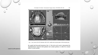 capitulo 6 proffit,capitulo 6 y 7 canut, capitulo 1,2,3 gregroret
 