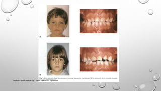 capitulo 6 proffit,capitulo 6 y 7 canut, capitulo 1,2,3 gregroret
 