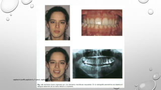 capitulo 6 proffit,capitulo 6 y 7 canut, capitulo 1,2,3 gregroret
 