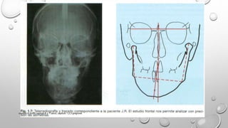 capitulo 6 proffit,capitulo 6 y 7 canut, capitulo 1,2,3 gregroret
 