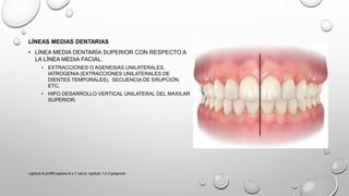 LÍNEAS MEDIAS DENTARIAS
• LÍNEA MEDIA DENTARÍA SUPERIOR CON RESPECTO A
LA LÍNEA MEDIA FACIAL.
• EXTRACCIONES O AGENESIAS UNILATERALES,
IATROGENIA (EXTRACCIONES UNILATERALES DE
DIENTES TEMPORALES), SECUENCIA DE ERUPCIÓN,
ETC.
• HIPO DESARROLLO VERTICAL UNILATERAL DEL MAXILAR
SUPERIOR.
capitulo 6 proffit,capitulo 6 y 7 canut, capitulo 1,2,3 gregroret
 