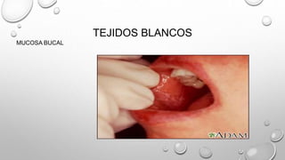 TEJIDOS BLANCOS
MUCOSA BUCAL
 