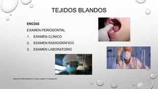 TEJIDOS BLANDOS
ENCÍAS
EXAMEN PERIODONTAL
1. EXAMEN CLÍNICO
2. EXAMEN RADIOGRÁFICO
3. EXAMEN LABORATORIO
capitulo 6 proffit,capitulo 6 y 7 canut, capitulo 1,2,3 gregroret
 