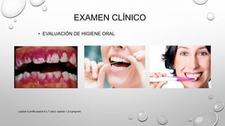 EXAMEN CLÍNICO
• EVALUACIÓN DE HIGIENE ORAL
capitulo 6 proffit,capitulo 6 y 7 canut, capitulo 1,2,3 gregroret
 