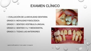 EXAMEN CLÍNICO
• EVALUACIÓN DE LA MOVILIDAD DENTARIA
GRADO 0: MOVILIDAD FISIOLÓGICA
GRADO 1: SENTIDO VESTIBULO-LINGUAL
GRADO 2: SENTIDO V-L Y MESIODISTAL
GRADO 3: TODAS LAS ANTERIORES
capitulo 6 proffit,capitulo 6 y 7 canut, capitulo 1,2,3 gregroret
 