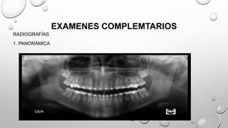 EXAMENES COMPLEMTARIOS
RADIOGRAFÍAS
1. PANORÁMICA
 