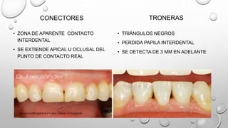 CONECTORES
• ZONA DE APARENTE CONTACTO
INTERDENTAL
• SE EXTIENDE APICAL U OCLUSAL DEL
PUNTO DE CONTACTO REAL
TRONERAS
• TRIÁNGULOS NEGROS
• PERDIDA PAPILA INTERDENTAL
• SE DETECTA DE 3 MM EN ADELANTE
capitulo 6 proffit,capitulo 6 y 7 canut, capitulo 1,2,3 gregroret
 