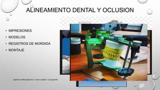 ALINEAMIENTO DENTAL Y OCLUSION
• IMPRESIONES
• MODELOS
• REGISTROS DE MORDIDA
• MONTAJE
capitulo 6 proffit,capitulo 6 y 7 canut, capitulo 1,2,3 gregroret
 