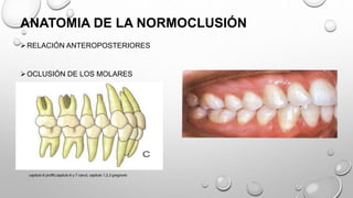 ANATOMIA DE LA NORMOCLUSIÓN
RELACIÓN ANTEROPOSTERIORES
OCLUSIÓN DE LOS MOLARES
OCLUSIÓN DE LOS CANINOS
capitulo 6 proffit,capitulo 6 y 7 canut, capitulo 1,2,3 gregroret
 