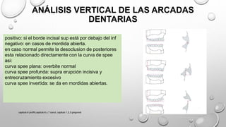 positivo: si el borde incisal sup está por debajo del inf
negativo: en casos de mordida abierta.
en caso normal permite la desoclusion de posteriores
esta relacionado directamente con la curva de spee
asi:
curva spee plana: overbite normal
curva spee profunda: supra erupción incisiva y
entrecruzamiento excesivo
curva spee invertida: se da en mordidas abiertas.
ANÁLISIS VERTICAL DE LAS ARCADAS
DENTARIAS
capitulo 6 proffit,capitulo 6 y 7 canut, capitulo 1,2,3 gregroret
 