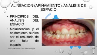 ALINEACION (APIÑAMIENTO): ANALISIS DE
ESPACIO
Cantidad de
espacio
disponible
para
alineación
Espacio
necesario
para alinear
• PRINCIPIOS DEL
ANALISIS DEL
ESPACIO
• Malalineación y el
apiñamiento suelen
ser el resultado de
una falta de
espacio
capitulo 6 proffit,capitulo 6 y 7 canut, capitulo 1,2,3 gregroret
 
