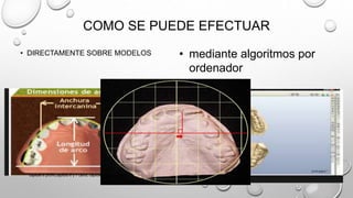 COMO SE PUEDE EFECTUAR
• DIRECTAMENTE SOBRE MODELOS • mediante algoritmos por
ordenador
capitulo 6 proffit,capitulo 6 y 7 canut, capitulo 1,2,3 gregroret
 