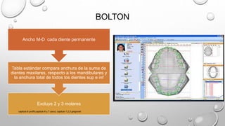 BOLTON
Excluye 2 y 3 molares
Tabla estándar compara anchura de la suma de
dientes maxilares, respecto a los mandibulares y
la anchura total de todos los dientes sup e inf
Ancho M-D cada diente permanente
capitulo 6 proffit,capitulo 6 y 7 canut, capitulo 1,2,3 gregroret
 